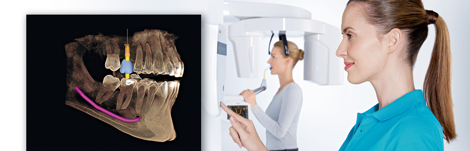 Dr. Marcus Klein - 3-D Implantatplanung